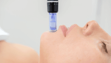 Image for Microneedling | Collagen Induction Therapy (CIT)